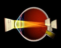 astigmatism-2.jpg